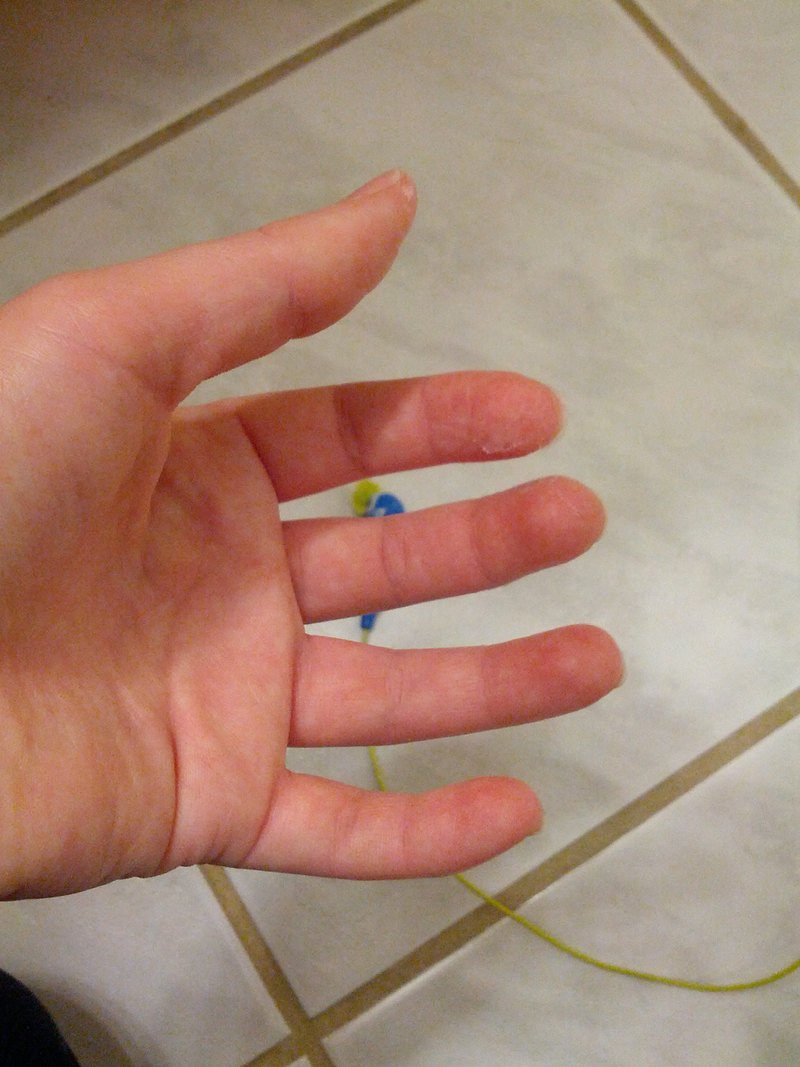 Illustration for article titled Removing Loctite From Fingers